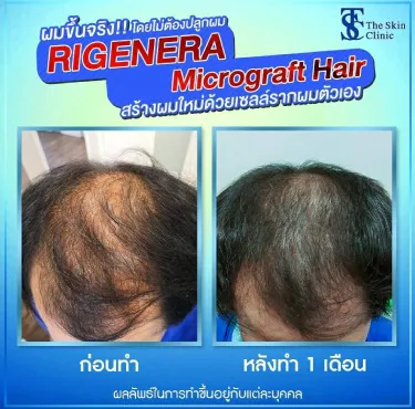 https://www.hair-theskinclinic.com/wp-content/uploads/2024/05/82D259ED-40FE-611F-571A-39E8BC5A6EDF.webp